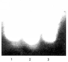 双歧杆菌诱导HT29细胞mRNA转膜电泳分析